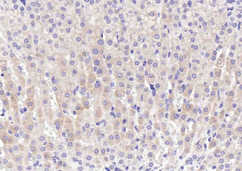 IGF2R/M6PR Rabbit Polyclonal Antibody
