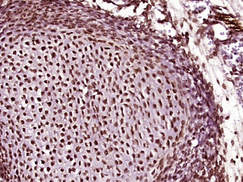 MEIS1 Rabbit Polyclonal Antibody