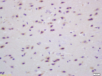 Transglutaminase-1 Rabbit Polyclonal Antibody