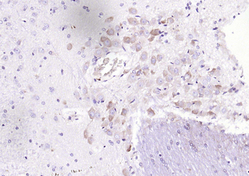 GANAB Rabbit Polyclonal Antibody