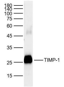 TIMP-1 Rabbit Polyclonal Antibody