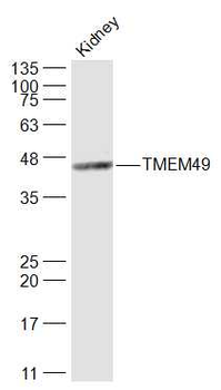 TMEM49 Rabbit Polyclonal Antibody