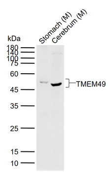 TMEM49 Rabbit Polyclonal Antibody