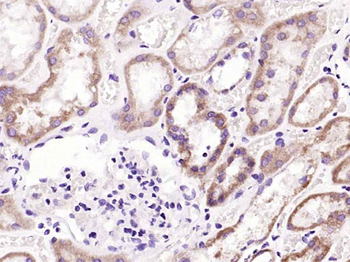 AAT Rabbit Polyclonal Antibody