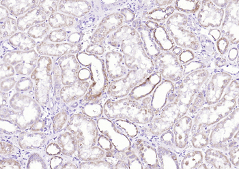 AAT Rabbit Polyclonal Antibody