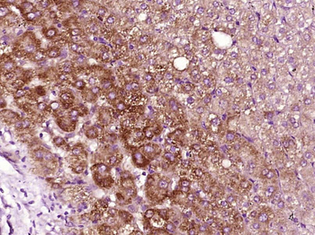 AAT Rabbit Polyclonal Antibody