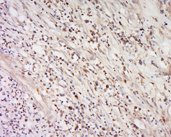 IFNA16/Interferon alpha 16 Rabbit Polyclonal Antibody