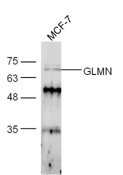 GLMN Rabbit Polyclonal Antibody