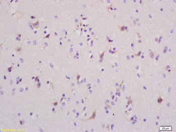 Kidins220 Rabbit Polyclonal Antibody