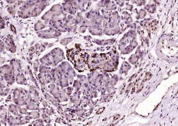 Insulin Receptor R Rabbit Polyclonal Antibody