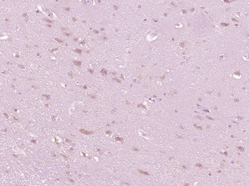 IL-10 Rabbit Polyclonal Antibody