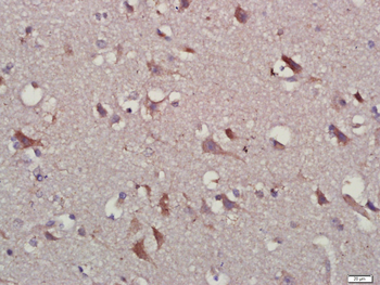 IL-10 Rabbit Polyclonal Antibody