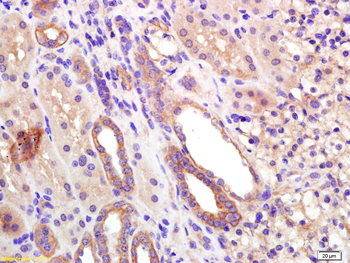 EDG3 Rabbit Polyclonal Antibody