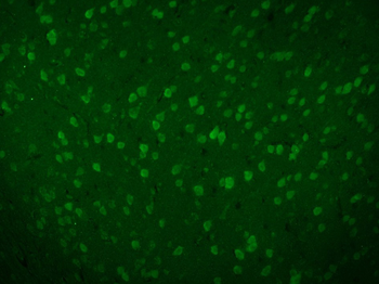 Beta galactosidase Rabbit Polyclonal Antibody