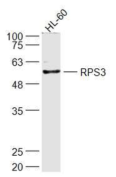 RPS3 Rabbit Polyclonal Antibody