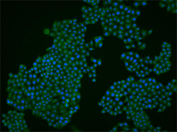 ZHX2 Rabbit Polyclonal Antibody