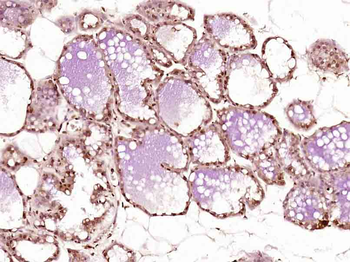 ZHX2 Rabbit Polyclonal Antibody