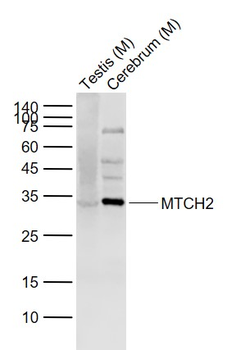 MTCH2 Rabbit Polyclonal Antibody