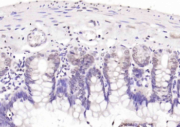 DNase I Rabbit Polyclonal Antibody