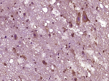 DNase I Rabbit Polyclonal Antibody