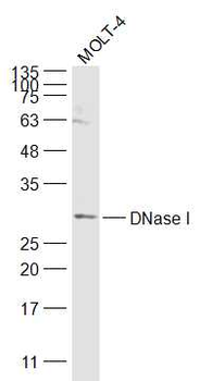 DNase I Rabbit Polyclonal Antibody