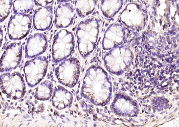 EAF2 Rabbit Polyclonal Antibody