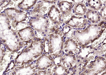 ABCB6 Rabbit Polyclonal Antibody