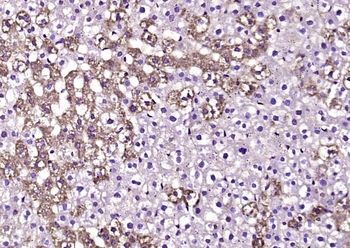 ABCB6 Rabbit Polyclonal Antibody