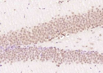 TRIP1 Rabbit Polyclonal Antibody