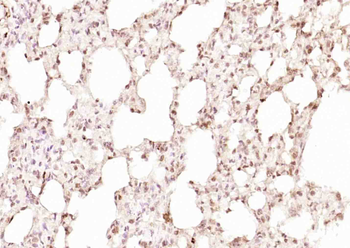 TRIP1 Rabbit Polyclonal Antibody