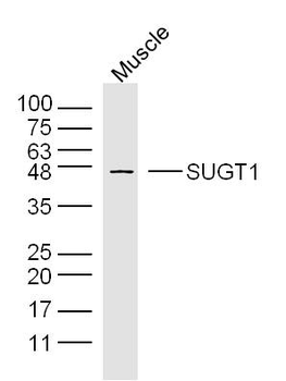 SUGT1 Rabbit Polyclonal Antibody
