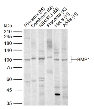 BMP1 Rabbit Polyclonal Antibody