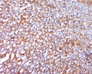 BMP1 Rabbit Polyclonal Antibody