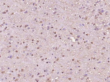 Phospho-Histone H1.4 (Thr18) Rabbit Polyclonal Antibody