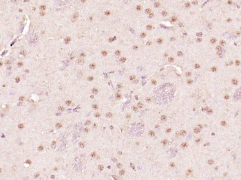 Phospho-Histone H1.4 (Thr18) Rabbit Polyclonal Antibody