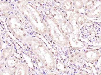 Phospho-Histone H1.4 (Thr18) Rabbit Polyclonal Antibody