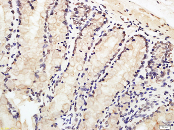 XRCC3 Rabbit Polyclonal Antibody