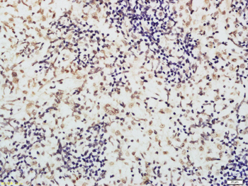 XRCC3 Rabbit Polyclonal Antibody