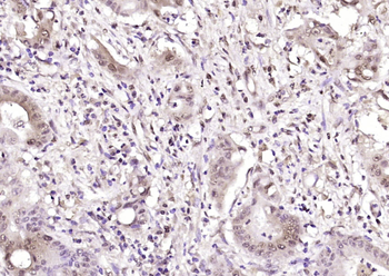 ABL2 Rabbit Polyclonal Antibody