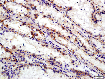 Integrin Alpha V + Beta 6 Rabbit Polyclonal Antibody