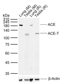 ACE Rabbit Polyclonal Antibody