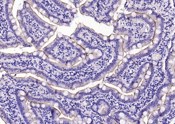 ACE2 Rabbit Polyclonal Antibody
