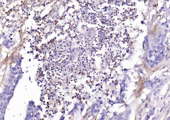 ACE2 Rabbit Polyclonal Antibody