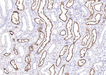ACE2 Rabbit Polyclonal Antibody