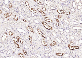 ACE2 Rabbit Polyclonal Antibody