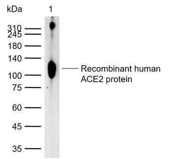 ACE2 Rabbit Polyclonal Antibody
