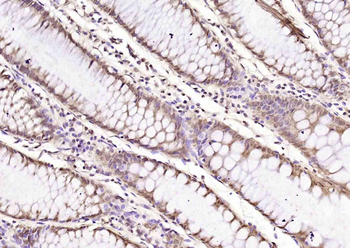 YB1 Rabbit Polyclonal Antibody