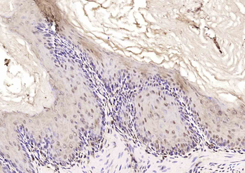 YB1 Rabbit Polyclonal Antibody