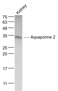 AQP2 Rabbit Polyclonal Antibody