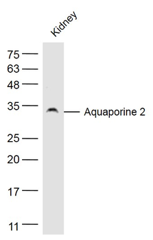 AQP2 Rabbit Polyclonal Antibody